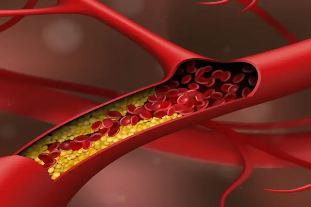 Consecuencias de la Artritis y Cómo los Suplementos Pueden Ayudar