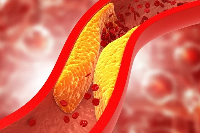 Consecuencias de la Artritis y Cómo los Suplementos Pueden Ayudar